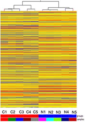 A Novel LncRNA, AC091729.7 Promotes Sinonasal Squamous Cell Carcinomas Proliferation and Invasion Through Binding SRSF2